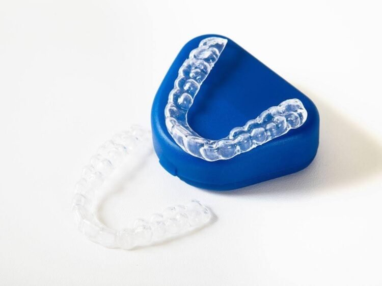 How Often Should Clear Aligners Be Changed?
